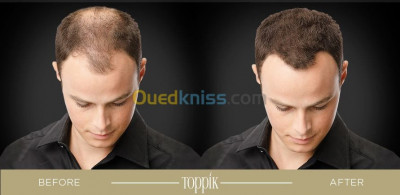 cheveux-promo-pack-toppik-مثبت-بخاخ-alger-centre-el-biar-algerie