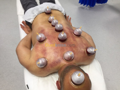 medecine-sante-hijama-cheraga-alger-algerie