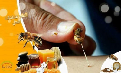 Venin abeille سم النحل