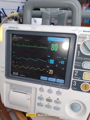 Holter ECG défi 