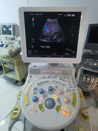 medical-echographe-hitachi-avius-avec-2-sondes-ain-oulmene-setif-algerie