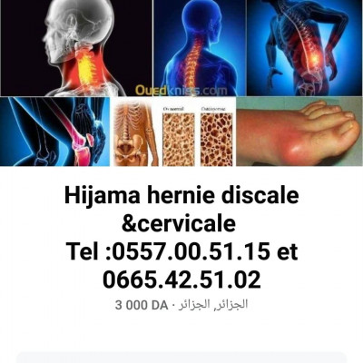 medecine-sante-hijama-medical-acupuncture-hernie-discale-alger-centre-algerie