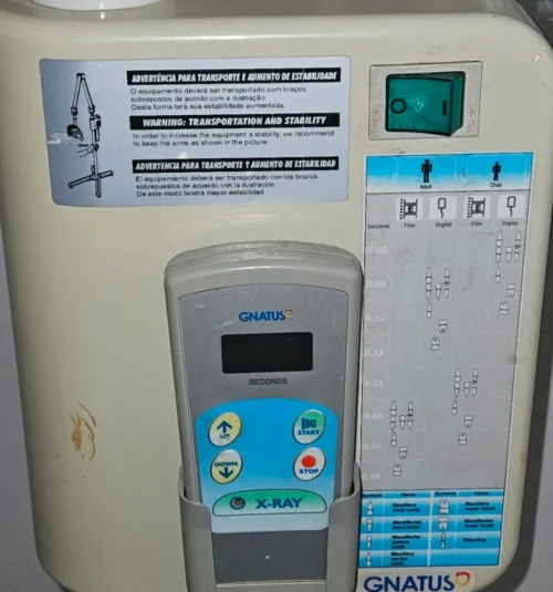 Radio dentaire gnatus mobile