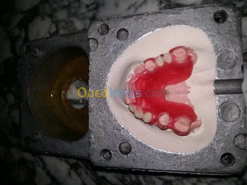 les prothèse  dentaire 