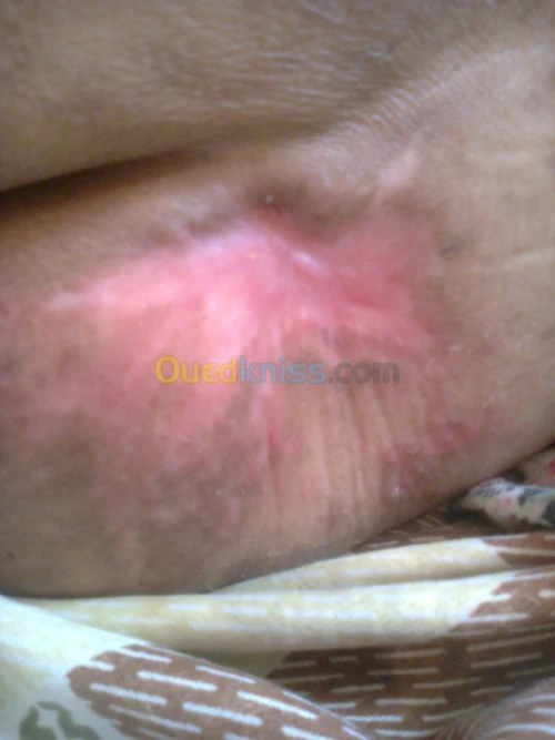 les soins infirmières à domicile