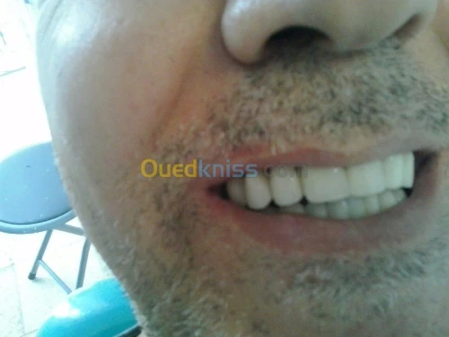  chirurgie dentaire
