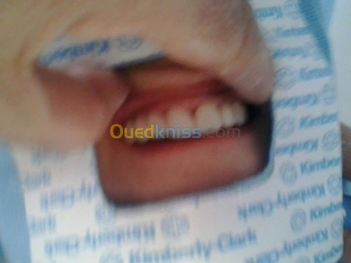  chirurgie dentaire