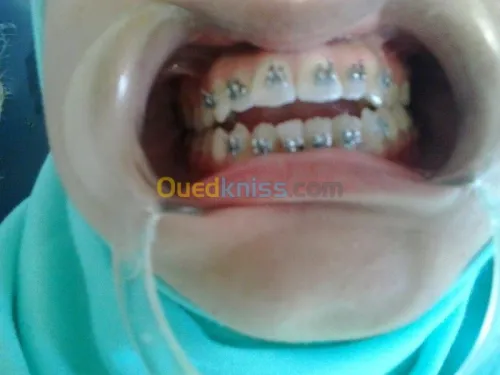  chirurgie dentaire