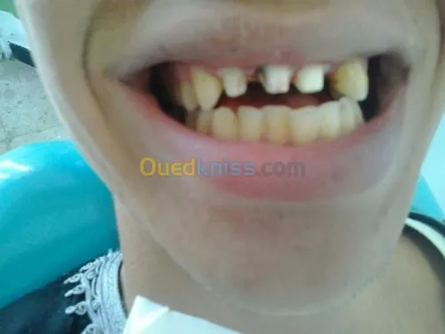  chirurgie dentaire