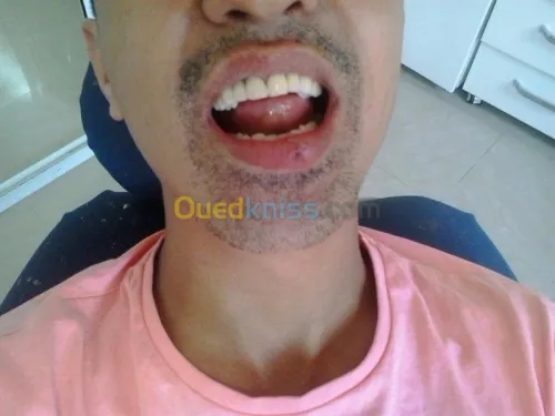 chirurgie dentaire