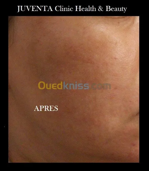 Santé & Beauté 