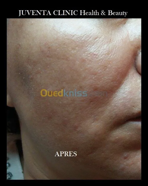 Santé & Beauté 