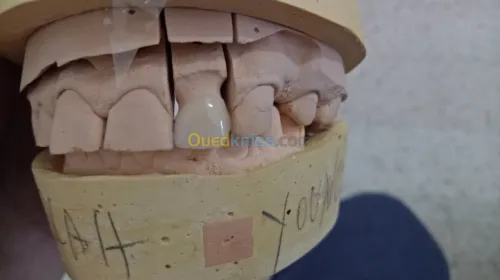 IMPLANTOLOGIE ( implant dentaire ) 