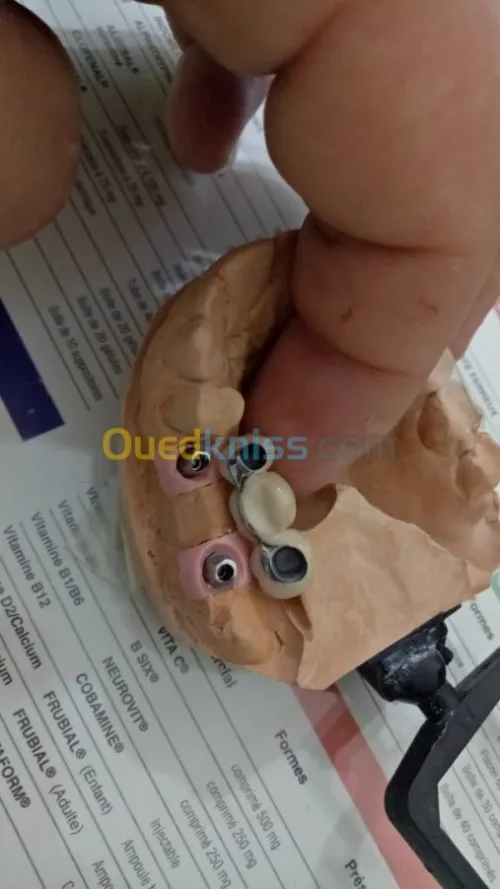 IMPLANTOLOGIE ( implant dentaire ) 