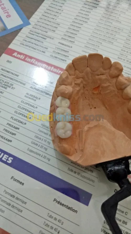 IMPLANTOLOGIE ( implant dentaire ) 