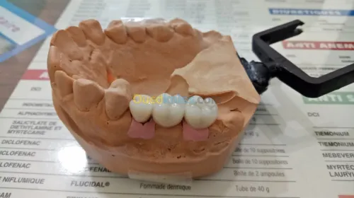 IMPLANTOLOGIE ( implant dentaire ) 
