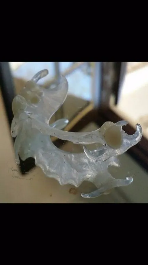 IMPLANTOLOGIE ( implant dentaire ) 