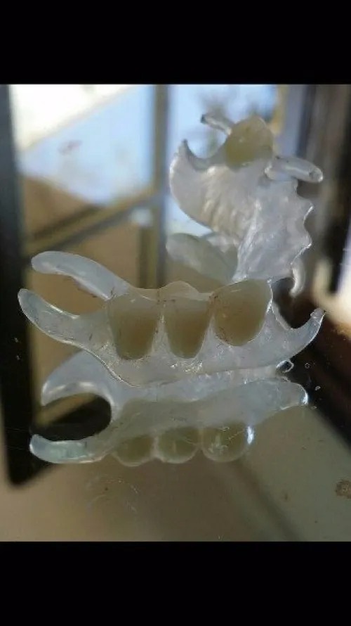 IMPLANTOLOGIE ( implant dentaire ) 