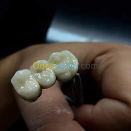 IMPLANTOLOGIE ( implant dentaire ) 