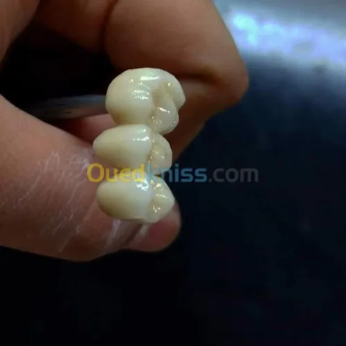 IMPLANTOLOGIE ( implant dentaire ) 