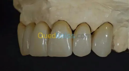 IMPLANTOLOGIE ( implant dentaire ) 