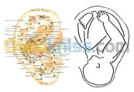 Formation en auriculotherapie
