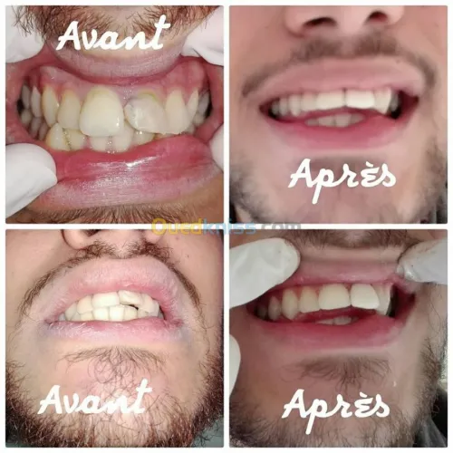 ODF 7/7 de 08h30 a 00h00 bon ramadan