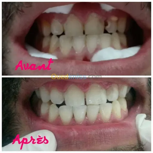 ODF 7/7 de 08h30 a 00h00 bon ramadan