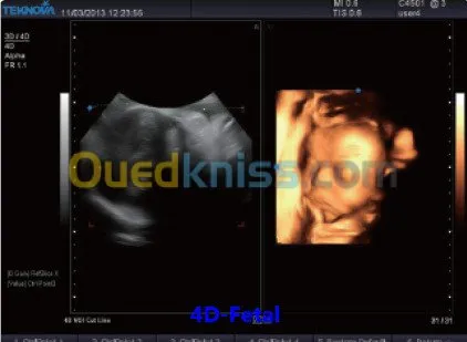 ECHOGRAPHE PAR FACILITE SANS INTERET