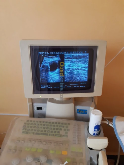 Echographe (ultra sondes )