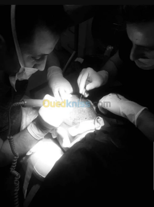 Implant capillaire 