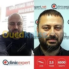 CHIRURUGIE ESTHETIQUE