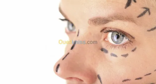 CHIRURUGIE ESTHETIQUE
