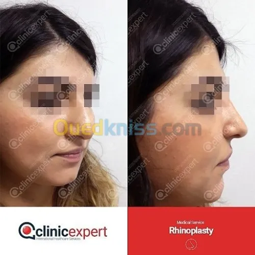 CHIRURUGIE ESTHETIQUE