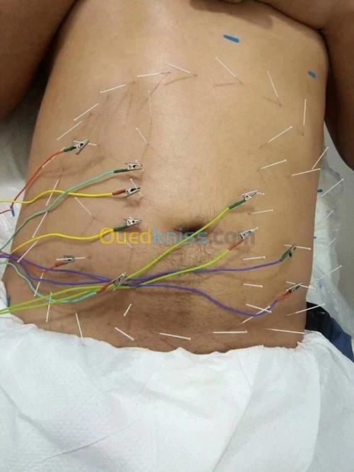 الطب البديل