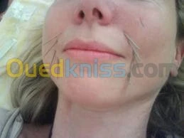 الطب البديل