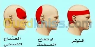 علاج الشقيقة والصداع والام المفاصل 