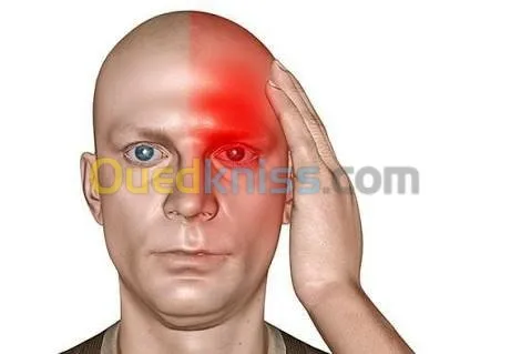 علاج الشقيقة والصداع والام المفاصل 