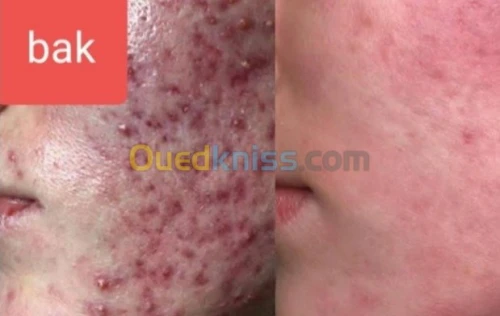 formation professionnelle