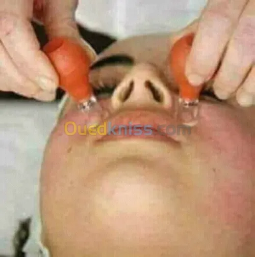 ACUPUNCTURE