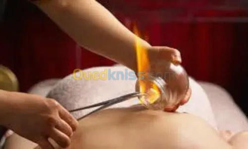 ACUPUNCTURE