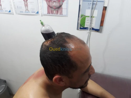 حجامة-hijama وقائية وعلاجية