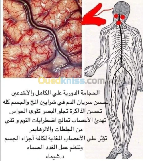 حجامة-hijama وقائية وعلاجية