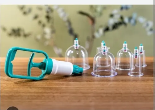 Hidjama cupping therapy