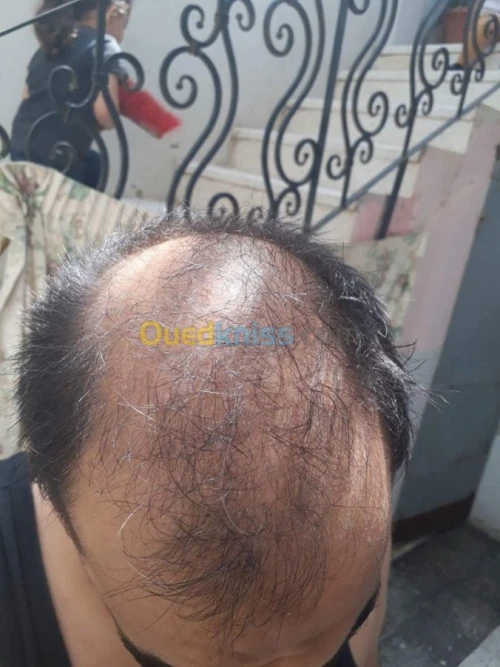 Toppik USA 27.5 Originale