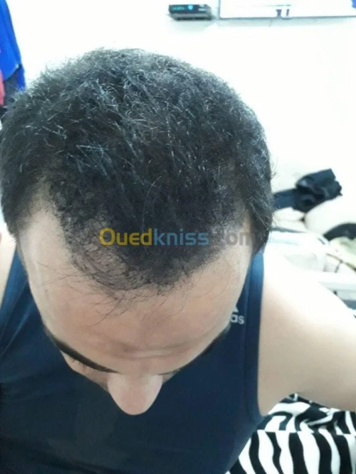 Toppik USA 27.5 Originale