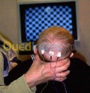 POTENTIELS ÉVOQUÉS VISUELS ( PEV )