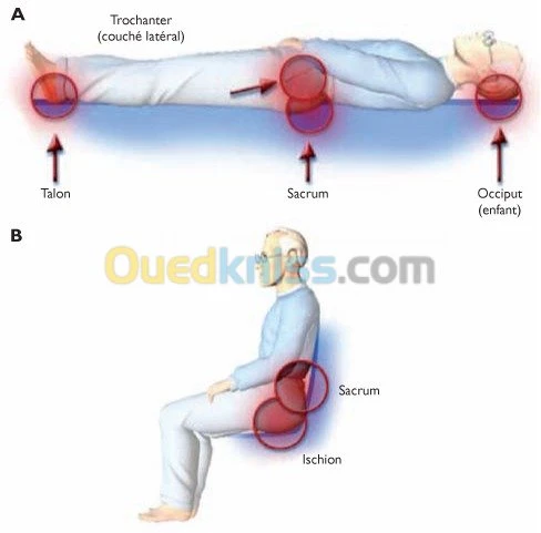 Matelas anti escarres de classe 1 type