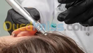 Microneedling et BBglow 