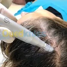 Microneedling et BBglow 